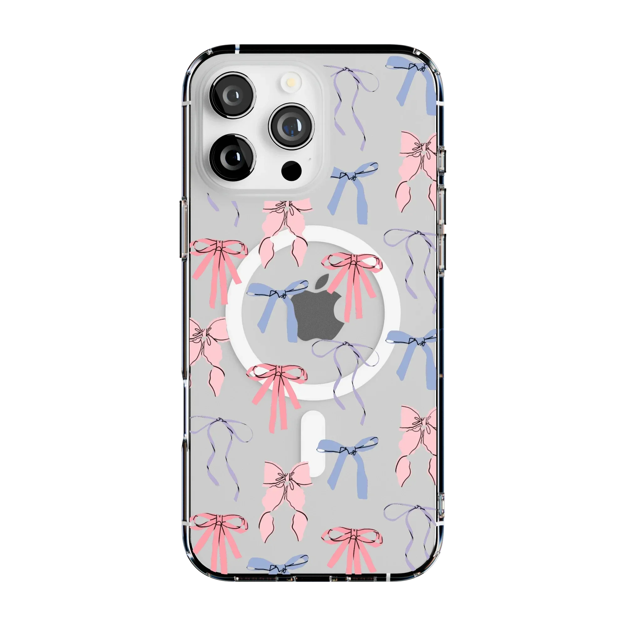 Coquette Girlie | Pastel Bows Case