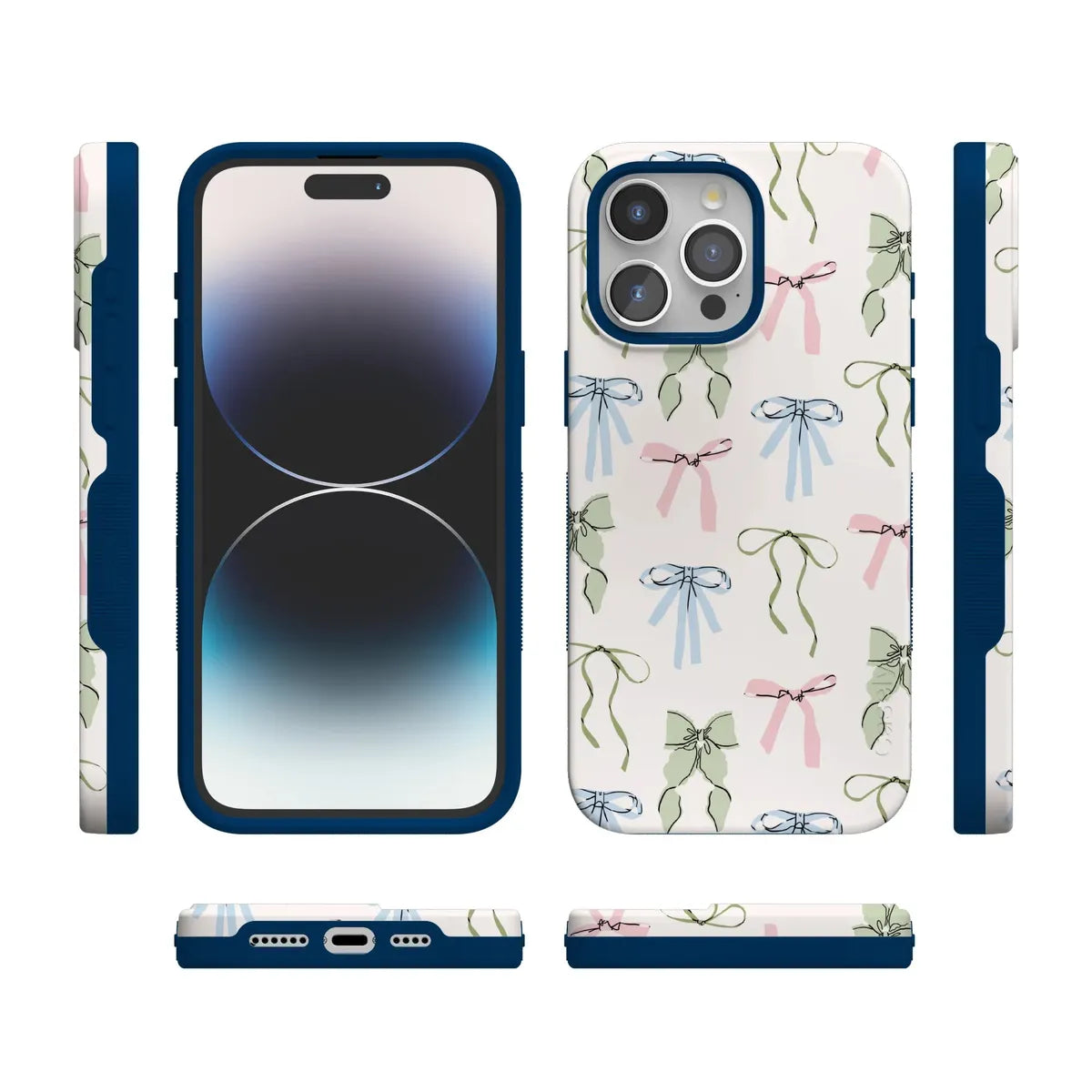 Whimsy Girlie | Pastel Bows Case